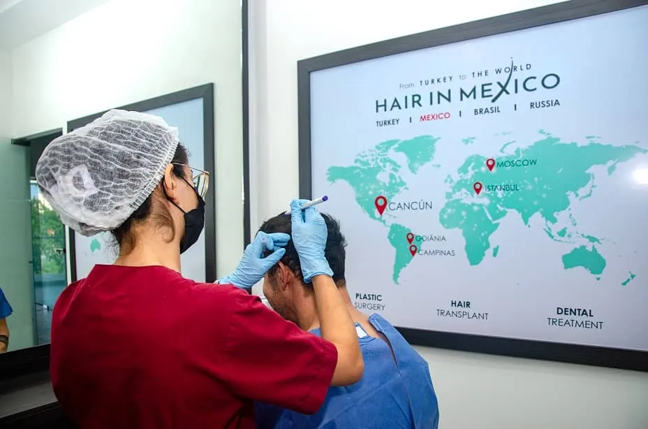 A Hair in Mexico specialist drawing a patient's new hairline